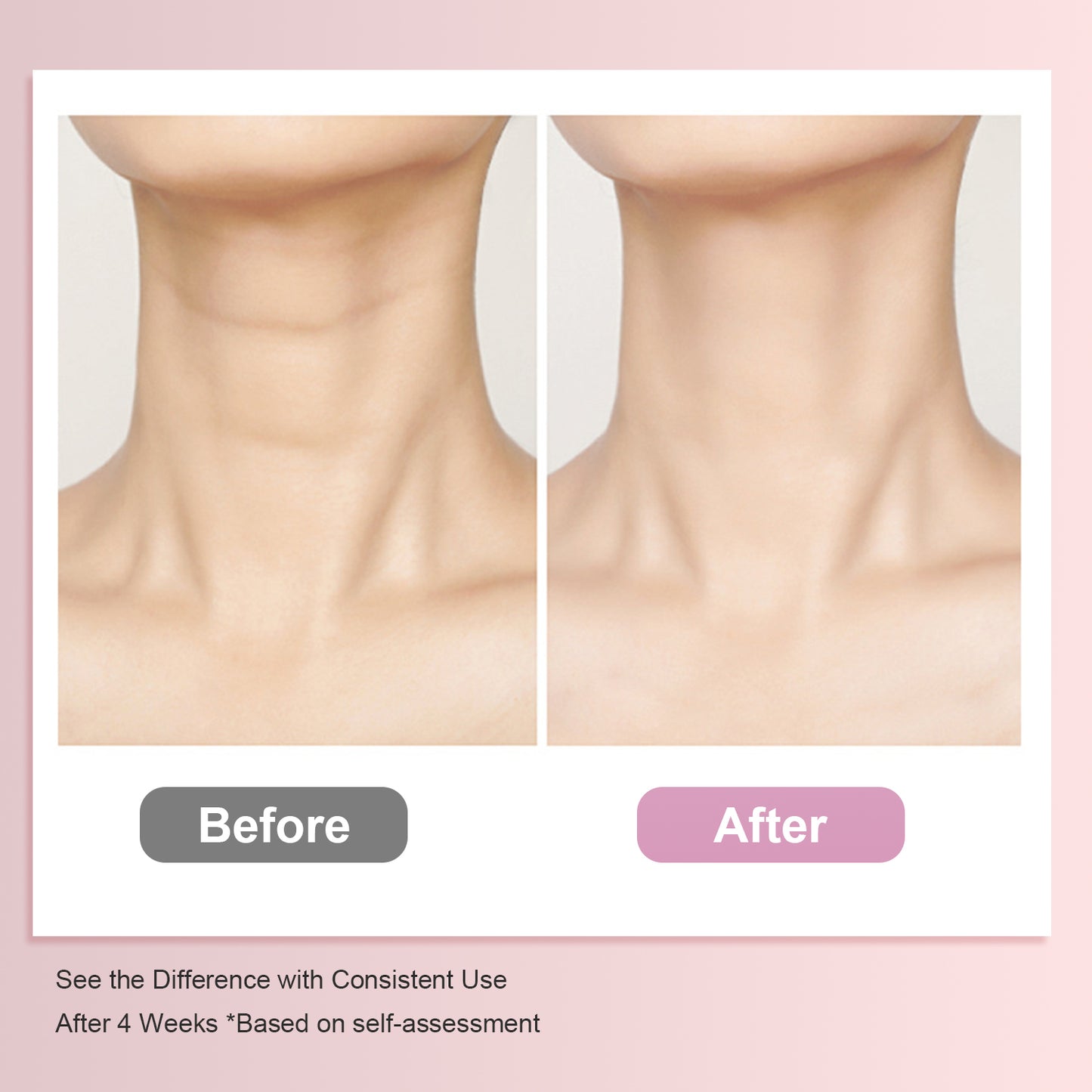 Tighten & Lift Neck Cream, 50g / 1.76 oz.